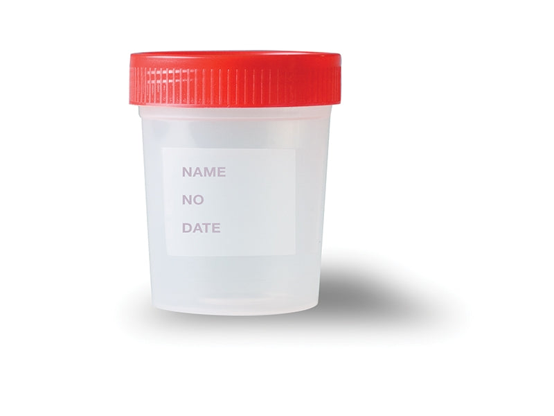 Gima Urine Sample Container
